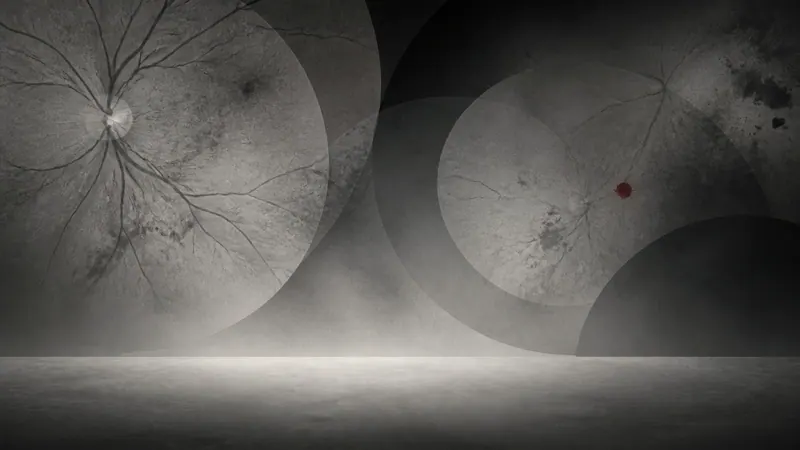 Retinal Disease Diagnosis Gaps