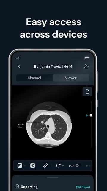 Qure.ai screenshot 1
