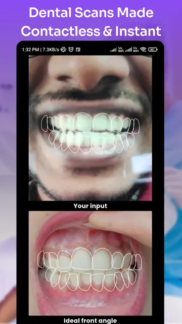 scanO care -AI dental checkups screenshot 2