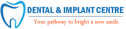Dental & Implant Center logo