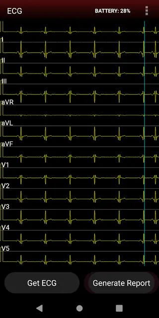ECG Connect screenshot 4